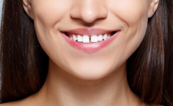 gaps in teeth