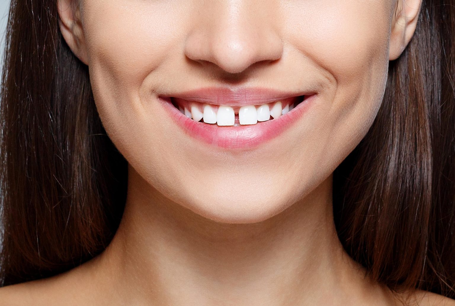 gaps in teeth